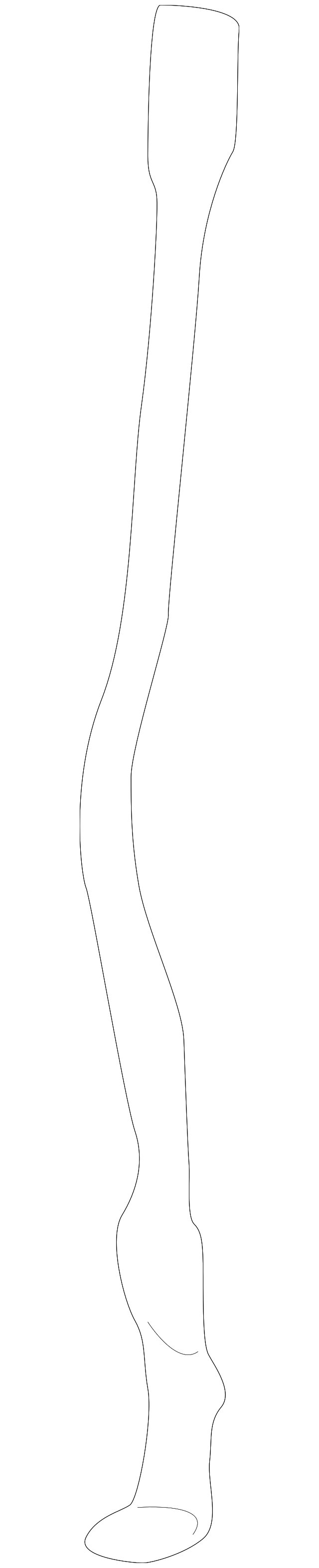 Radius Rod 3B0-805-489-F - View 5